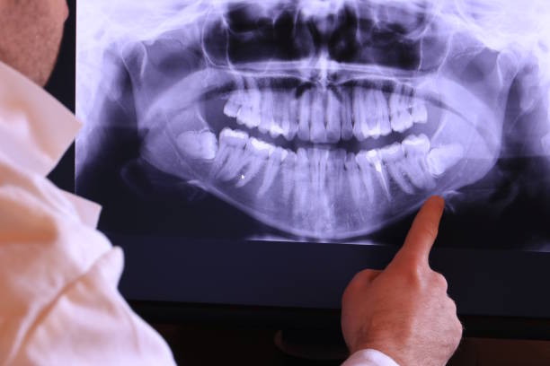 Best Emergency Dental Care for Broken or Chipped Teeth in Murrells Inlet, SC