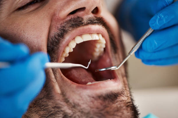 Best Weekend Emergency Dentist in Murrells Inlet, SC